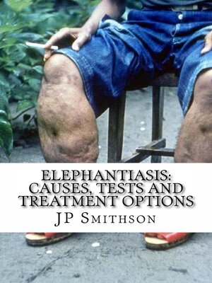cover image of Elephantiasis